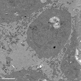 说明: F:\Publish\Euphorbia esula induced apoptosis\EM\WD_7.jpg